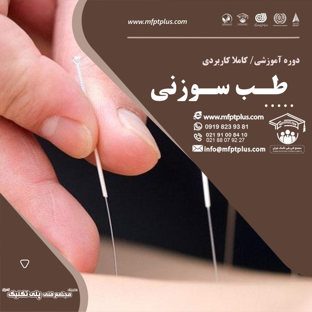 طب سوزنی